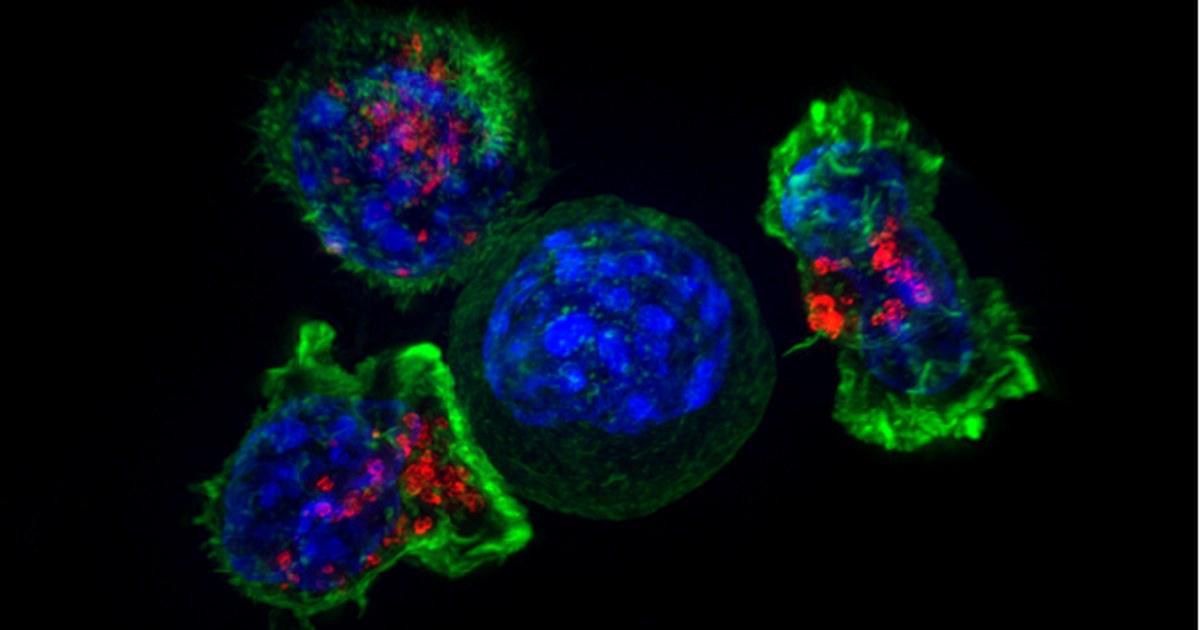 Killer T cells surrounding a cancer cell — 한쪽 암에 놓은 주사가 반대편 전이암까지 없앨 수 있을까